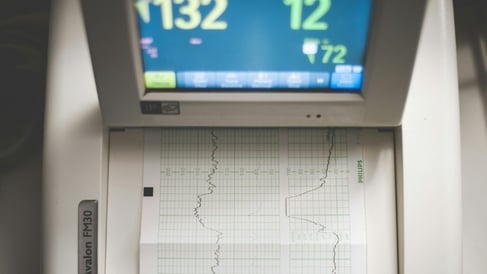 Electrocardiograma-pruebas-medicas-CESDA